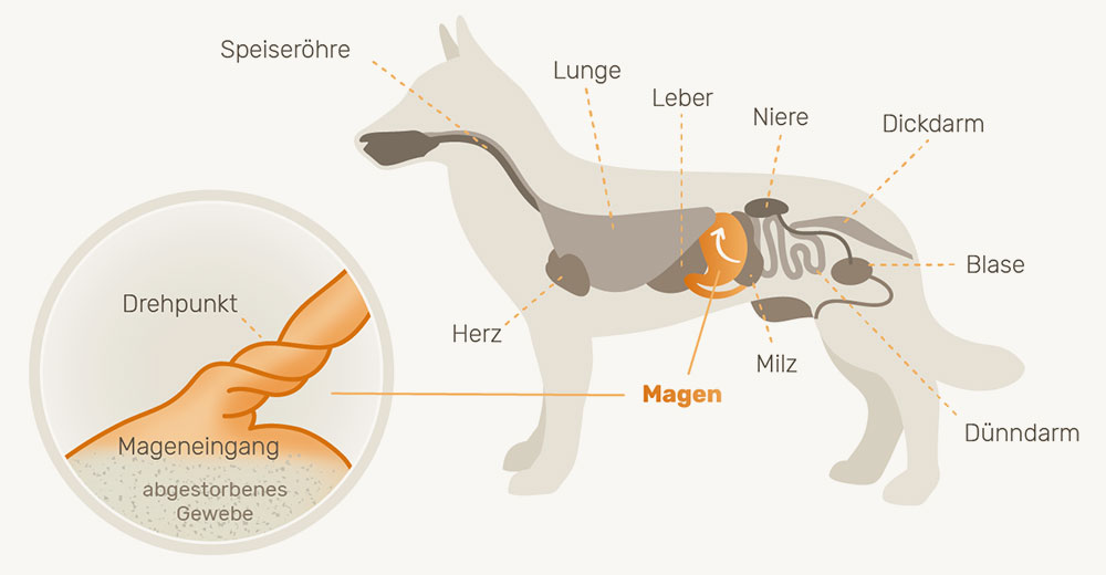 Schaubild, zeigt die Position von Magen und Milz und das umgebende Omentum