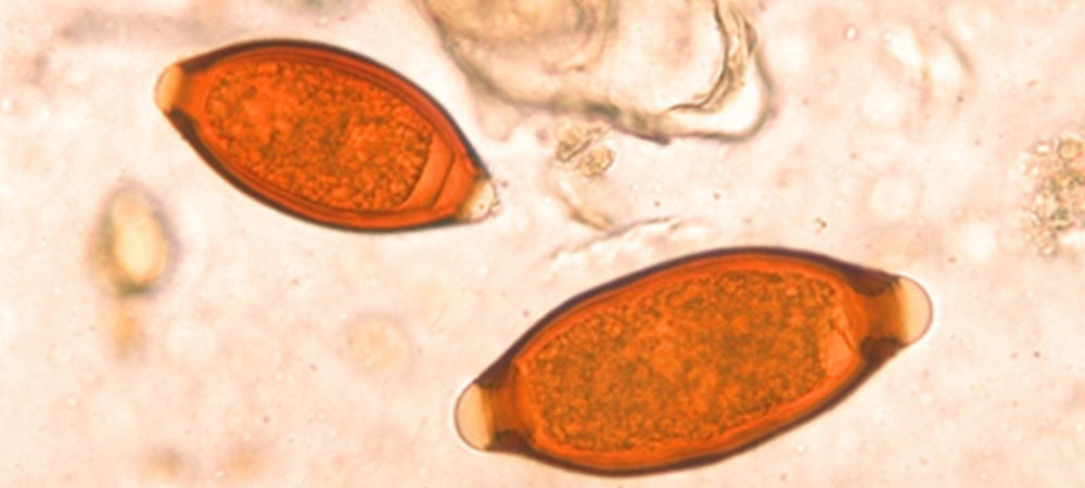 Eier des Peitschenwurms unter dem Mikroskop