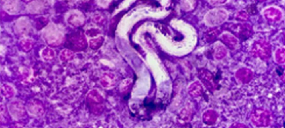 Mikrofilarien („Nachkommen“) von Herzwürmern