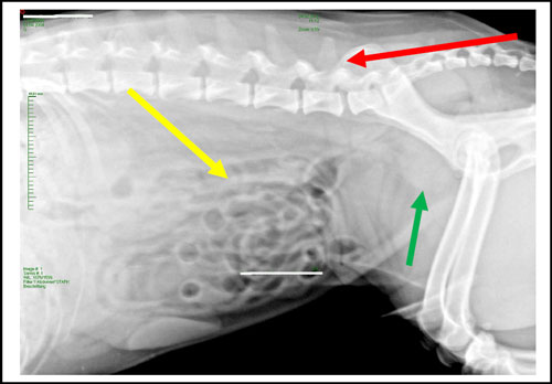 Arthrose - Röntgenbild